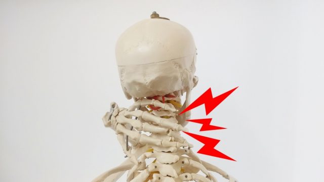 首痛の骨格模型