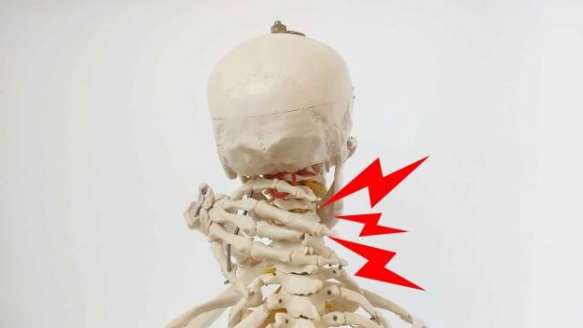 首痛の骨格模型